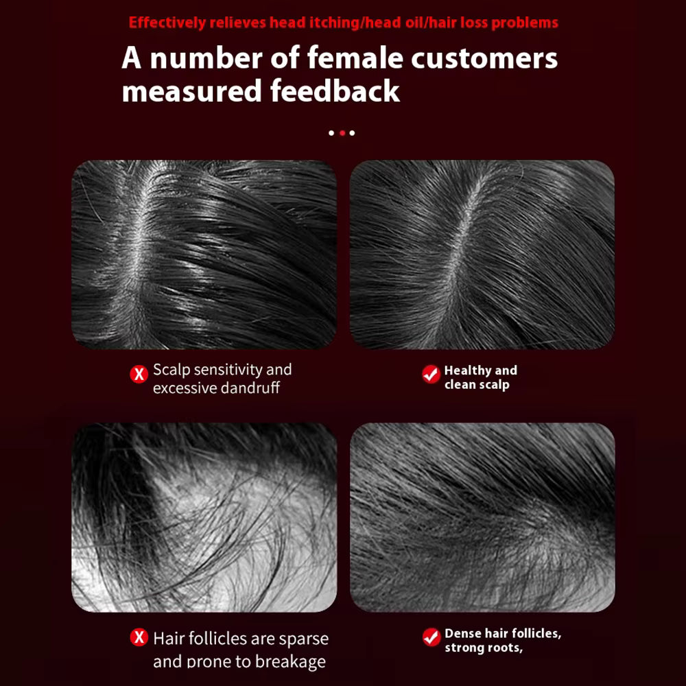 Elektrische Vibrerende Hoofdmassagekam