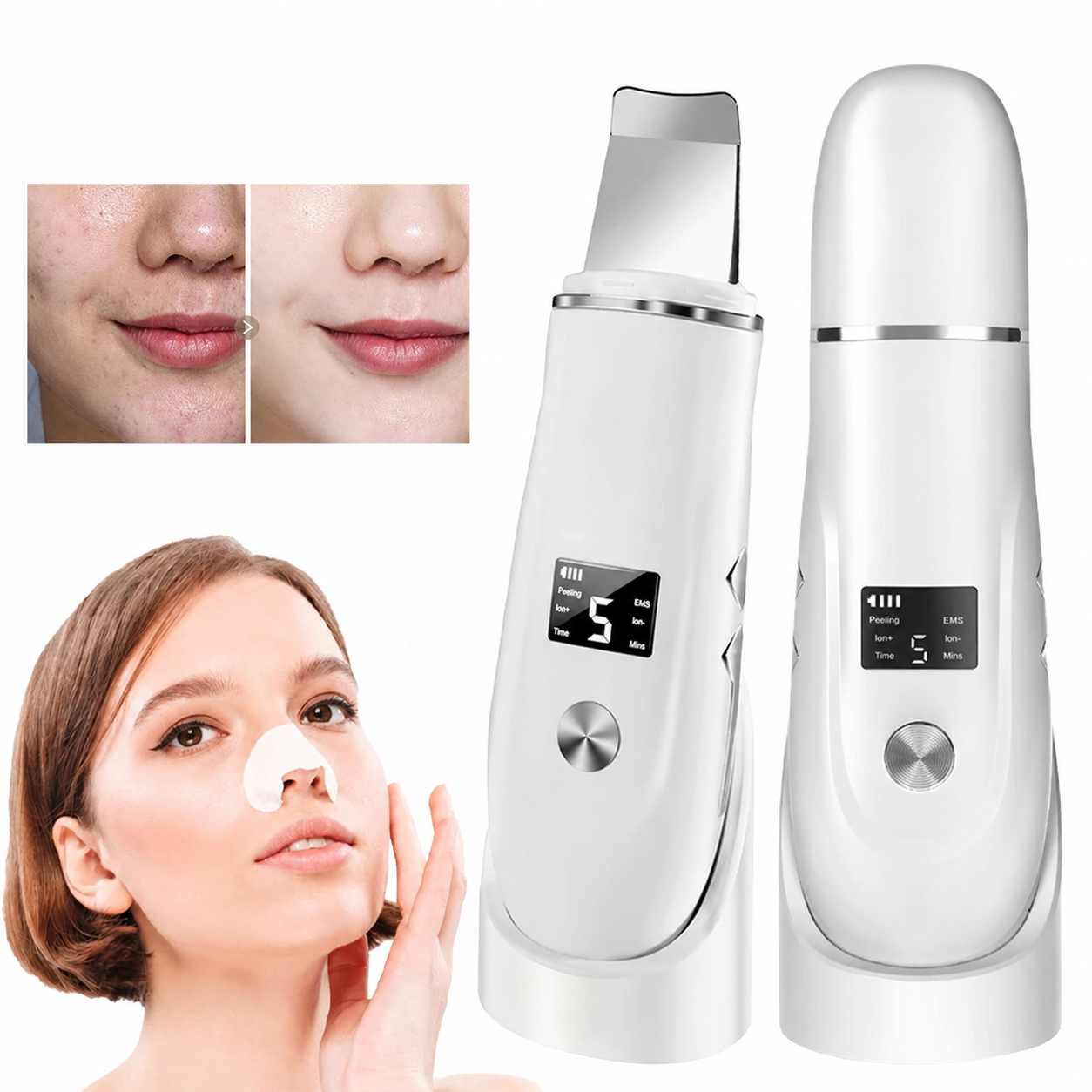 Ultrasonic Face Scrubber – Milde Dieptereiniging & Glow Boost