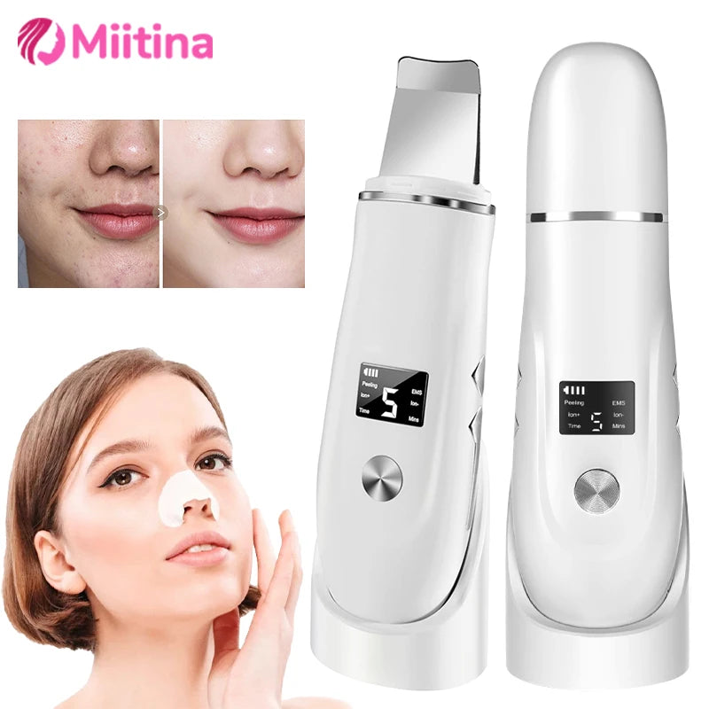 Ultrasonic Face Scrubber – Milde Dieptereiniging & Glow Boost