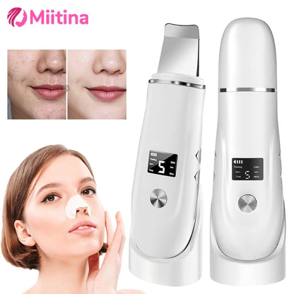 Ultrasonic Face Scrubber – Milde Dieptereiniging & Glow Boost