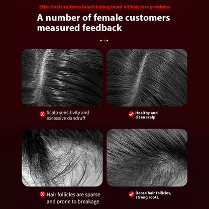 Elektrische Vibrerende Hoofdmassagekam