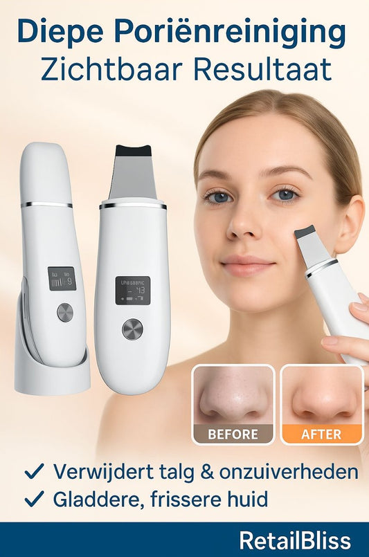 Ultrasonic Face Scrubber – Milde Dieptereiniging & Glow Boost
